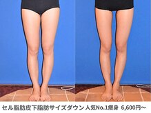 ピュアノア 垂水店/痩身ダイエット　神戸垂水明石