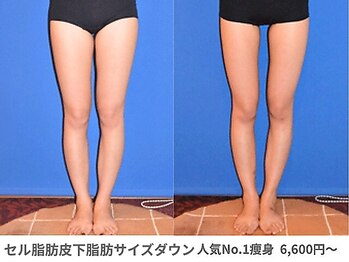 ピュアノア 垂水店/痩身ダイエット 神戸垂水明石