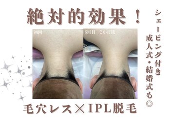 エステティック レイビス 銀座店(RAYVIS)/うなじ脱毛