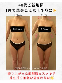 エーシーサロン 六本木店(acsalon)/お顔に触れずに小顔効果を発揮!