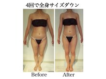 ナチュラーレ 天王寺店(Naturale)/痩身リンパマッサージ二の腕美脚