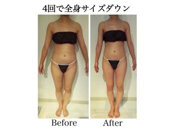 ナチュラーレ 天王寺店(Naturale)/痩身リンパマッサージ二の腕美脚