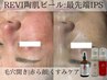 【9月限定】肌疲れリセット◎ピール：最先端IPSエクソソーム≪毛穴・くすみ≫