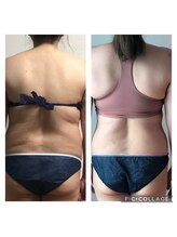 サロンシャイン(Salon Shine)/ダイエットカウンセリング