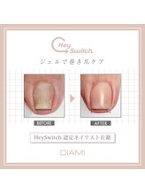 シェリエット(Cheriette)/最新技術！ジェルで巻き爪ケア