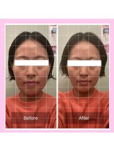 シエロ アスール(Cielo azul)/顔のサイズが違う…！？