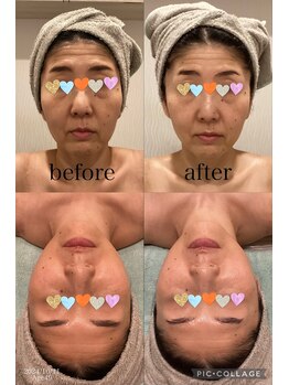 B.B藤沢 レオスタイル(LeoStyle)/NR機器はフェイシャルにも