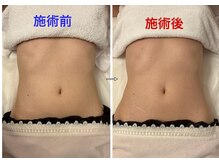 ナチューラ(Natura)/【ウエストくびれ】美ボディに♪