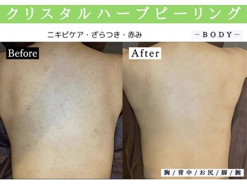 シャルムクリニカルサロン 池袋(Charme clinical salon)/