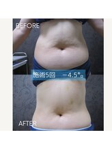 ヴィオテラス(VIOTERACE)/