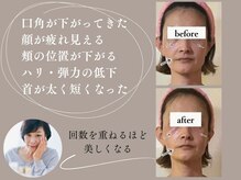 カラーズ(callas)