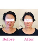 セルフィッシュ(Cellfish)/お顔も身体も一回り以上小さく♪