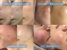 レイドボーテ(Ray de beaute)