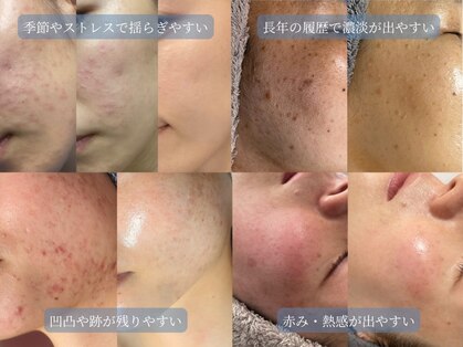 レイドボーテ(Ray de beaute)の写真