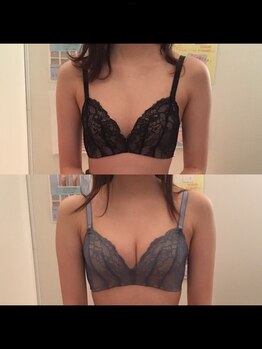 ヴィーナス(Venus)/バストケア