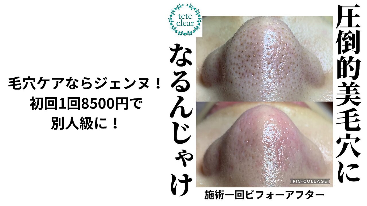 ジェンヌ(jenne.)｜ホットペッパービューティー