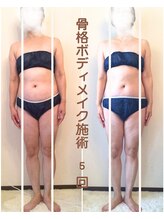 ハナ(hana)/歪みが改善された55歳のお客様