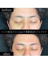 ユー 千葉駅前店(you)/ビフォ－アフター写真