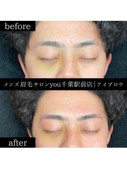 ユー 千葉駅前店(you)/ビフォ－アフター写真