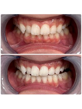 エクシアホワイトニング 日本橋店/水天宮前ホワイトニング