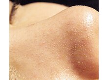 ビュップ 金沢店(美u p)の雰囲気（圧倒的人気ナンバーワンの毛穴lレス！）