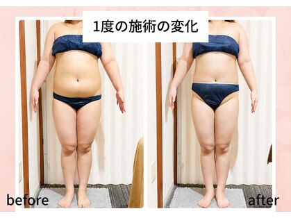 ゲットレディー 本店(Get Lady)の写真