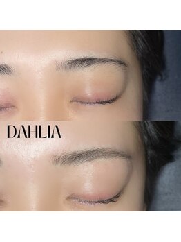 ダリア(Dahlia)/眉毛のワックス脱毛