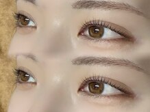 ルネラ 札幌大通(LUNELLA)/話題のピーナッツロッド