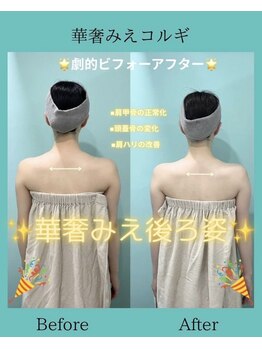 アコガレコガオ 鳥取店/コルギのビフォーアフター