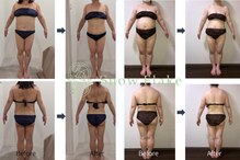 スノーフレイク(SnowFlake)