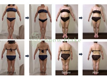 スノーフレイク(SnowFlake)