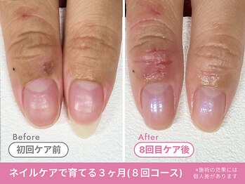 Before/After【feerie立川】