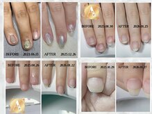 アルムネイル(ARUM nail)の雰囲気（自爪育成の成果◇爪の形が綺麗になる楽しみを）