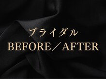 シーフェイス 横浜店(SEE FACE)/横浜ブライダルエステ/二の腕