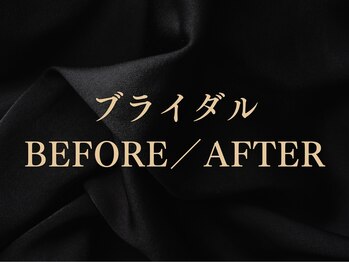 シーフェイス 横浜店(SEE FACE)/横浜ブライダルエステ/二の腕