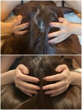 【美容整体×小顔矯正】Lilria/【頭蓋骨矯正】30代