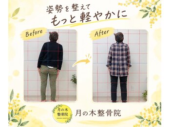 月の木整骨院の写真/骨盤矯正や猫背矯正で姿勢を整え、腰痛や肩こりをケア！毎日を心地良く☆
