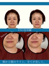 ハリラボ(hari Lab.)/【お客様の声】