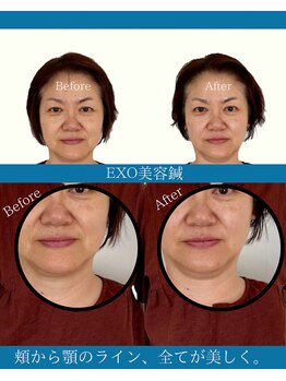 ハリラボ(hari Lab.)/【お客様の声】