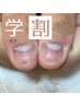 学割U24／深爪矯正初回＋育成オイル