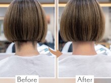 【Care】ネープケア脱 毛で後ろ姿まで美しく◎男女に大人気！