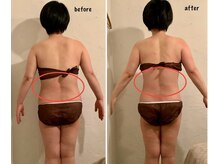 トリート(TREAT)/ビフォー&アフター　Y様(後）