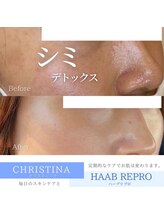 フルアナ(Hu ruana)/フェイシャルエステ