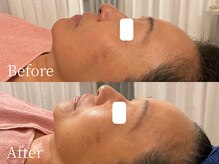 アナパ・オラ/タラソトリートメント当日の結果