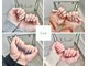 ユーネイル(U nail)の写真