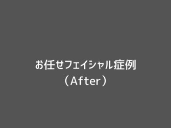 オアシスラグーン(OASIS LAGOON)/お任せフェイシャル