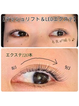 リラクア(Rela Qua)/【流行の エクパー♪】