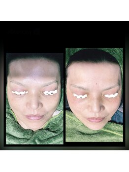 ココスタイルビューティー(COCOSTYLE beauty)/ララピール