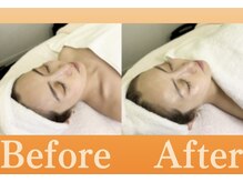 ナーススキン(nurse skin)/ビフォーアフター3