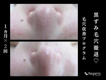 レガロビューティクリエイションズ桜川店/脱・黒ずみ！毛穴改善プログラム